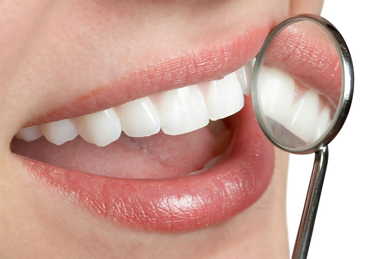 Clean Dental Dental Offer